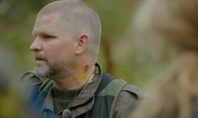 FIKK ARR: Paintballkula gikk gjennom huden til Håvard Lilleheie og etterlot et sår. Foto: TV 2 FIKK ARR: Paintballkula gikk gjennom huden til Håvard Lilleheie og etterlot et sår. Foto: TV 2